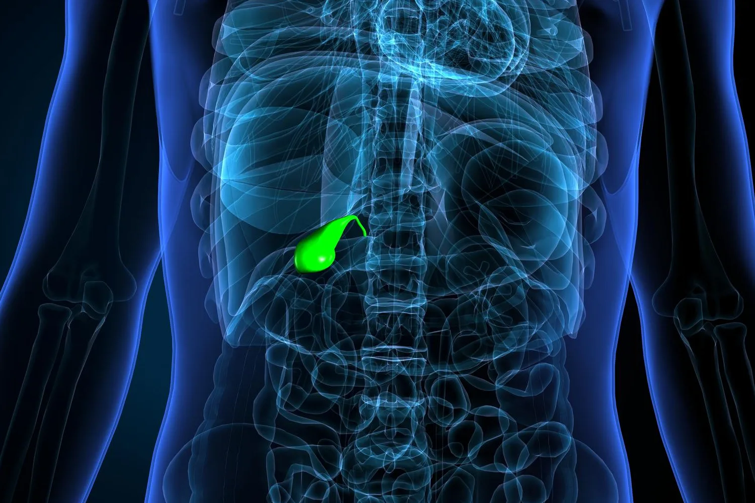 Colecistectomía laparoscópica